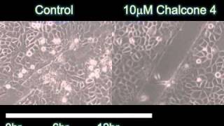 A Pivotal Role for CXCL12 Signaling in HPVMediated Transformation of Keratinocytes [upl. by Sucramad440]