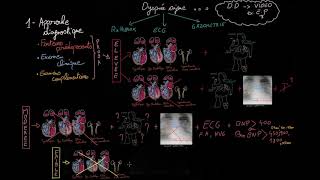 Insuffisance cardiaque aiguë en 3 étapes  Partie 1  Docteur Synapse [upl. by Erastes]