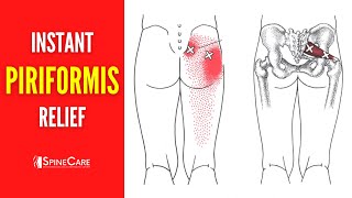 How to Get Rid of Piriformis Pain FOR GOOD [upl. by Aliuqaj438]