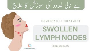 Swollen Lymph Nodes in Neck Homeopathic Treatment  SCROFULA ENLARGED GLANDS  Bioplasgen 22 [upl. by Ennelram]