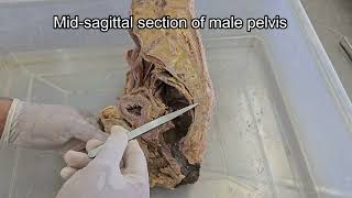 Mid sagittal section of Pelvis  Male and Female [upl. by Yasui681]