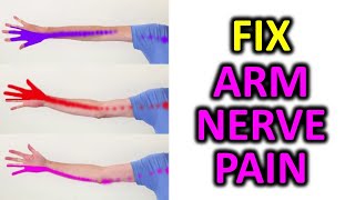 3 Exercise To Relieve Arm Pain Numbness Pins and Needles [upl. by Lasky]