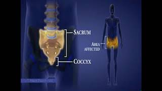 Spinal Cord Injuries I Areas Affected by Level of Injury [upl. by Appleby]