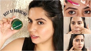 Top 5 Surprising Uses of BOROLINE🤔  Remove Pimple amp Acne in 3 Days  Beauty Hacks [upl. by Previdi986]