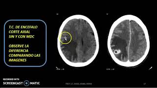 Conceptos basicos de Diagnostico por Imagenes [upl. by Angie]