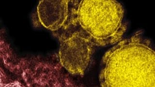 Just how dangerous is MERS [upl. by Roshelle]