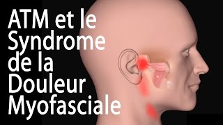 L’ATM et le Syndrome de la Douleur Myofasciale Animation [upl. by Hgierb]