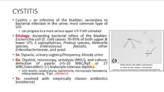 TUBULOINTERSTITIAL DISORDER INTRO amp CYSTITIS [upl. by Yleoj]