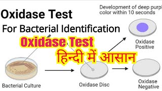 Oxidase test in hindi  Bacterial identification  Microbiology [upl. by Velick689]