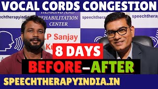 BeforeAfter Dysphonia  Vocal Cords Congestion  Within 8 Days  SLPSanjayKumar  AIIMS Alumnus [upl. by Nolrev]