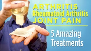 5 Amazing Treatments for Arthritis Rheumatoid Arthritis and Joint Pain That Work [upl. by Laekcim813]