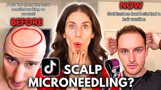 Can You Grow Back Hair With Scalp Microneedling Does Scalp Microneedling Work [upl. by Atinas585]