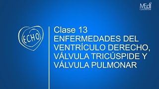 CLASE 13  Enfermedades del Ventrículo Derecho Válvula Tricúspide y Válvula Pulmonar [upl. by Alroy]