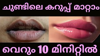 എത്ര കറുത്ത ചുണ്ടും ചുവന്നു തുടുക്കാൻ l Get Pink Lips in 1 Use l Lighten Dark Lips Naturally  Home [upl. by Musetta887]