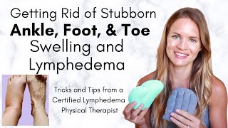 Toe Foot and Ankle Lymphedema and Swelling  Tricks to get Rid of Stubborn Lymphedema [upl. by Ecam]