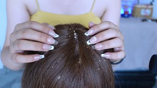 ASMR  Dandruff Removal amp Scalp Check Extremely Satisfying [upl. by Canty757]