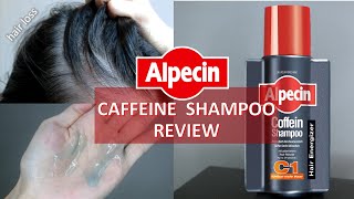 ALPECIN Caffeine Shampoo Review 咖啡因洗发露🧐对抗脱发有效吗？ [upl. by Vevina692]