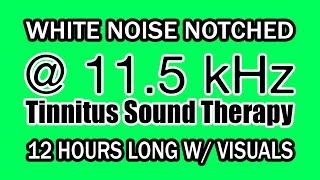 White Noise  Notch Filtered at 115 kHz for Tinnitus Therapy w VIsuals [upl. by Edelson469]