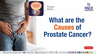 Causes of Prostate Cancer  What are the Causes of Prostate Cancer  prostatecancer [upl. by Anibas510]