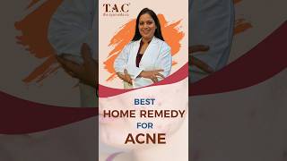 Best Acne Treatment at Home  Acne Home Remedy  Home Made Face Pack [upl. by Arny]