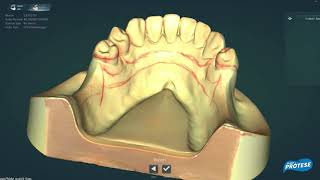 Scanner Dental Up360 Up3D  Dental Prótese [upl. by Demp]