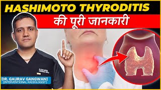 Complete Information About Hashimoto thyroiditis  Dr Gaurav Gangwami Interventional Radiologist [upl. by Amil]