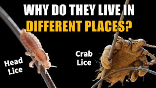 Where Did PubicCrab amp Body Lice Come From  The Coevolution of Lice [upl. by Kirsteni]