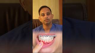 3 Symptoms of Mouth Cancer you shouldn’t IGNORE❌ oralcancerdoctor oralcancer mouthcancer [upl. by Laius]