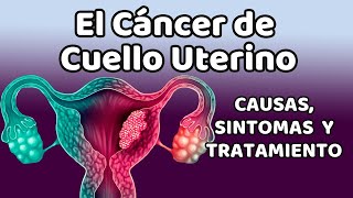 CÁNCER DE CUELLO UTERINO Causas signos y síntomas diagnóstico y tratamiento [upl. by Fromma276]