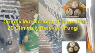 Fungal Colony morphology of more than twenty most common fungi [upl. by Ahsropal]