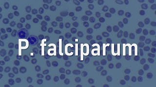 Plasmodium falciparum [upl. by Animehliw72]