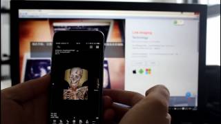 LinkCloud Mobile dicom viewer [upl. by Adlen]