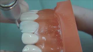 All ceramic crown tooth preparation for dental students [upl. by Yrgoerg]