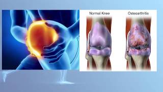 5 Best Prescription Arthritis Creams For Joint Pain [upl. by Anastatius505]