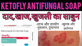 Ketoconazole amp Cetrimide Soap  Ketofly Soap  Medicine Review In Hindi Uses Side EffectsDosage [upl. by Lacombe]