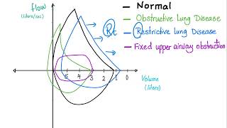 Flow Volume Loops  Respiratory Physiology  Pulmonary Medicine  Pulmonology Playlist [upl. by Strephonn]