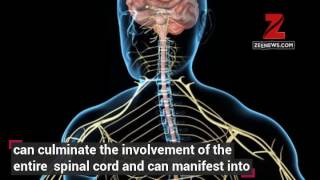 Cervical spondylitis Heres why the condition worsens in winter [upl. by Inverson]