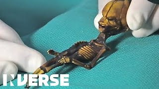 Atacama Skeleton Is A Mutant Not An Alien  Inverse [upl. by Katya]