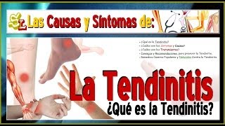 Remedios Caseros contra la Tendinitis Qué es la Tendinitis Causas Síntomas y Tratamientos [upl. by Ecneitap]