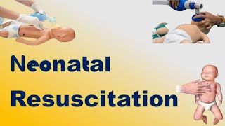 Neonatal Resuscitation  TOACS amp OSCE Station [upl. by Bain]