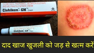 Clobikem Gm Cream Uses in Hindi [upl. by Sosthina]