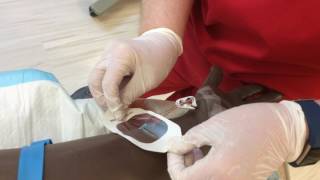 IV Insertion and Discontinue Procedure [upl. by Etteneg546]