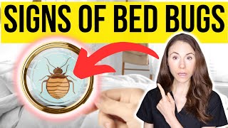 Signs You Have Bed Bugs And How To Get Rid Of Them [upl. by Xylina]