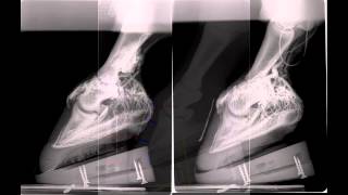 Acute laminitis radiographic and venographic progression [upl. by Luba]