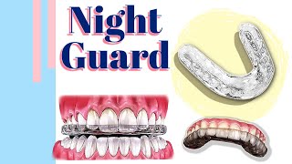 Night Guard  Types of the night guard  Mouth Splint [upl. by Gardner]