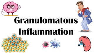 Granulomatous Inflammation  Types Pathophysiology Different Cell Types In Granuloma amp Examples [upl. by Luba]