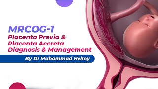 MRCOG1  Placenta Previa amp Placenta Accreta  Diagnosis amp Management  By Dr Muhammad Helmy [upl. by Ilrak]