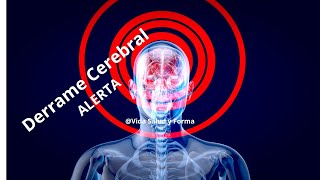 Derrame Cerebral ALERT  The Silent Killer in Your Head [upl. by Neehsuan740]