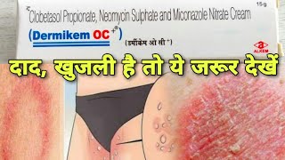 Dermikem OC crem दाद खाज ओर खुजली को जङ से मिटाने के लिए फंगल इन्फेमेस्किन इन्फेमे Medicine [upl. by Chester]