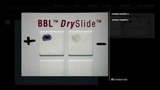 Oxidase Test DrySlide  Microbiology [upl. by Eladnwahs994]